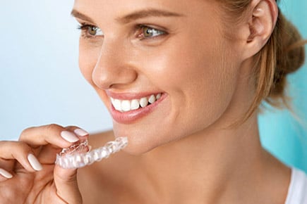 Invisalign em Piracicaba