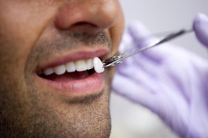Lente dental em Piracicaba